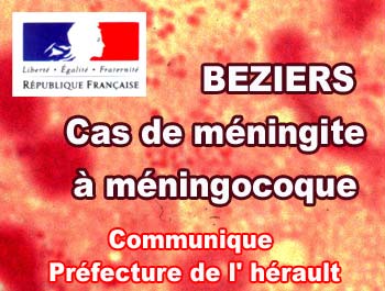 Cas De Méningite à Méningocoque à Béziers - Hérault Tribune